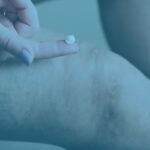 Treatment for Venous Leg Ulcers